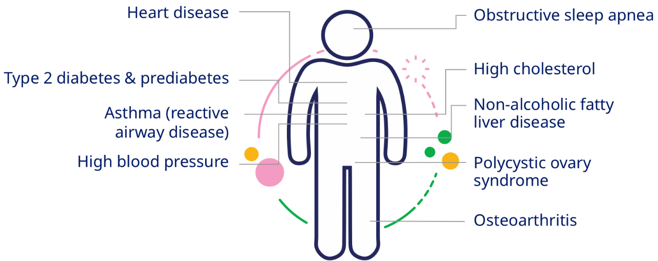 List of obesity comorbidities